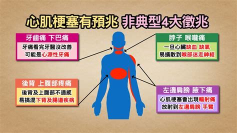 心臟旁邊是什麼|胸痛不可大意！醫師教你3分鐘觀察疼痛感受、位置及。